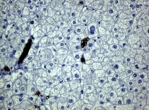 KRT19 / CK19 / Cytokeratin 19 Antibody (aa240-390, clone UMAB3, Carrier-free)