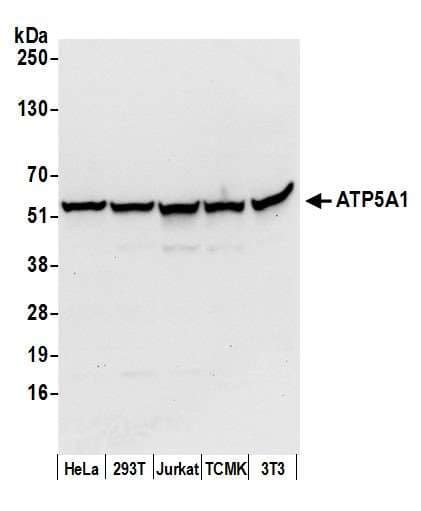 ATP5A1 / ATP Synthase Alpha Antibody (aa100-150)