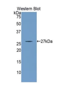 ANGPTL1 Antibody (aa271-491)
