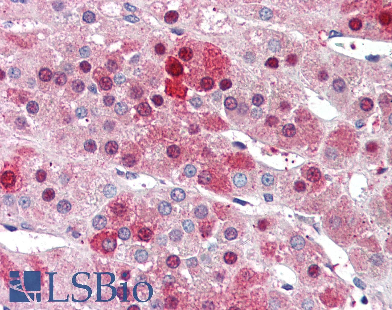 IHC-plus™ HEC1 / NDC80 Antibody (aa630-642)