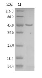 Woodchuck TNF Alpha Protein (Recombinant 6His-B2M, N-terminus)