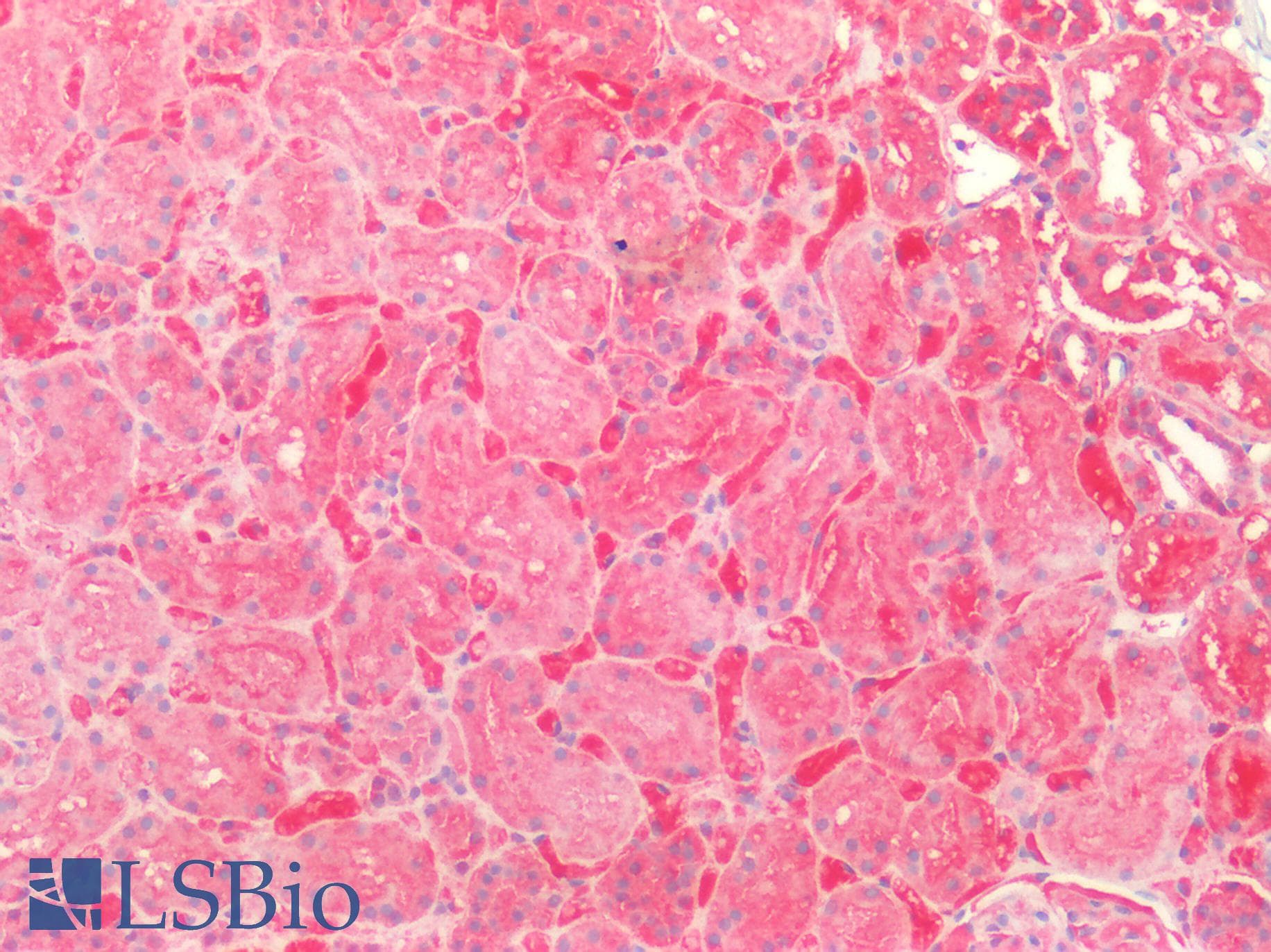 PathPlus™ SOD2 / Mn SOD Antibody (aa119-130)
