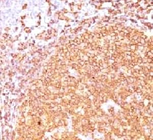 Monoclonal Mouse anti-Human CD20 Antibody (clone CDLA20-1, IHC, IF)