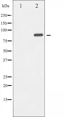 Polyclonal Rabbit anti-Human GRIA2 / GLUR2 Antibody (IHC, WB)