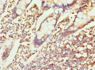 CHMP4B Antibody