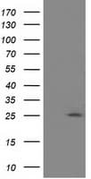 AK3 / Adenylate Kinase 3 Antibody (clone OTI4A2)