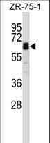 Polyclonal Rabbit anti-Human STAM2 Antibody (aa143-172, WB)
