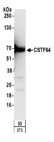 Polyclonal Rabbit anti-Human CSTF2 / CstF-64 Antibody (aa527-577, IHC, WB)