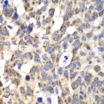 Polyclonal Rabbit anti-Human PARN Antibody (IHC, IF, WB)
