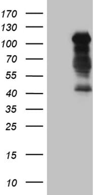 TCF12 / HEB Antibody (clone OTI2E11)