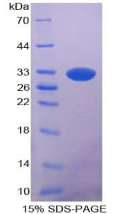 Rat PNLIP / PL / Pancreatic Lipase Protein (Recombinant His-T7)
