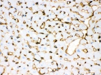 ANXA3 / Annexin A3 Antibody