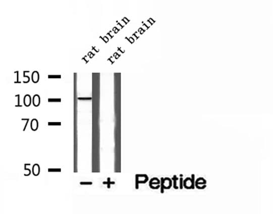 Polyclonal Rabbit anti-Human SYNPO2 / Synaptopodin 2 Antibody (IHC, WB)