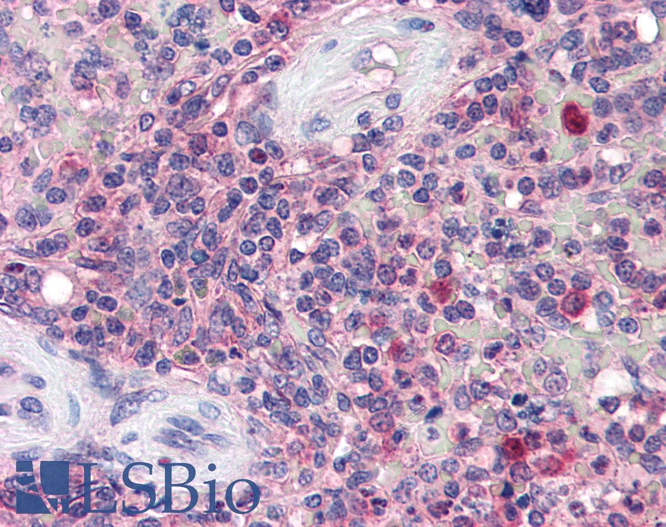 IHC-plus™ Polyclonal Goat anti-Human KPNB1 / Importin Beta Antibody (aa851-863, IHC, WB)