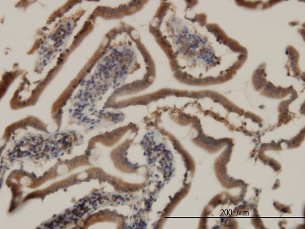 Monoclonal Mouse anti-Human CIDEB Antibody (clone 2A10, IHC, WB)