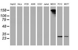 Monoclonal Mouse anti-Human PYCRL Antibody (clone OTI1B12, IHC, IF, WB)