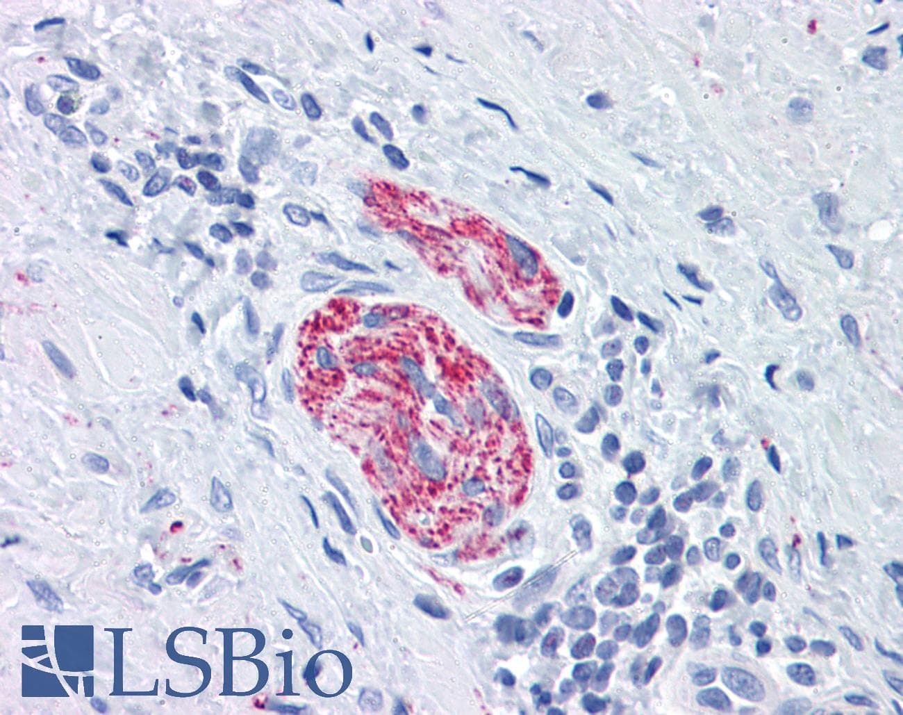 IHC-plus™ MAPT / Tau Antibody (Ser404)