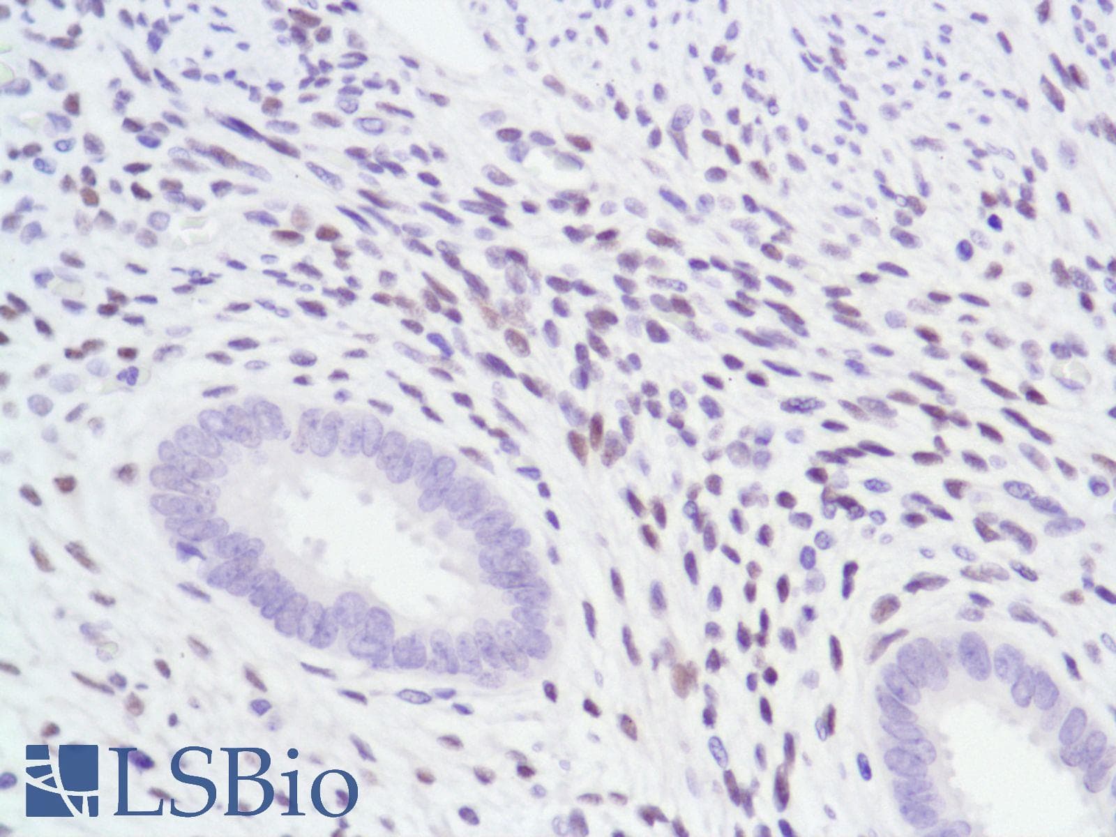 Monoclonal Rabbit anti-Human AR / Androgen Receptor Antibody (clone SP107, N-Terminus, IHC)