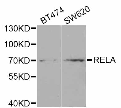 Polyclonal Rabbit anti-Human RELA / NFKB p65 Antibody (IHC, IF, WB)