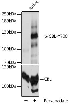 Polyclonal Rabbit anti-Human c-CBL Antibody (phospho-Tyr700, WB)