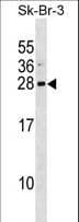 ARL1 Antibody (aa81-108)