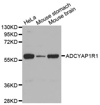 ADCYAP1R1 / PAC1 Receptor Antibody