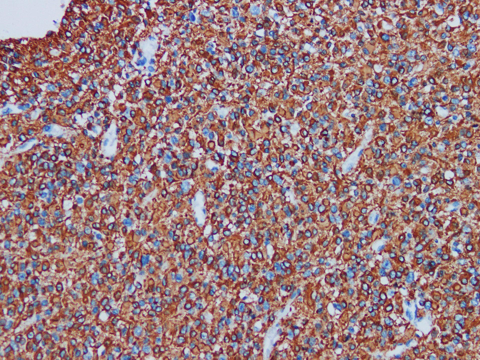 GFAP Antibody
