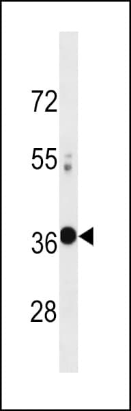 VAX2 Antibody (aa138-166)