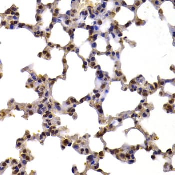 XRCC6 / Ku70 Antibody