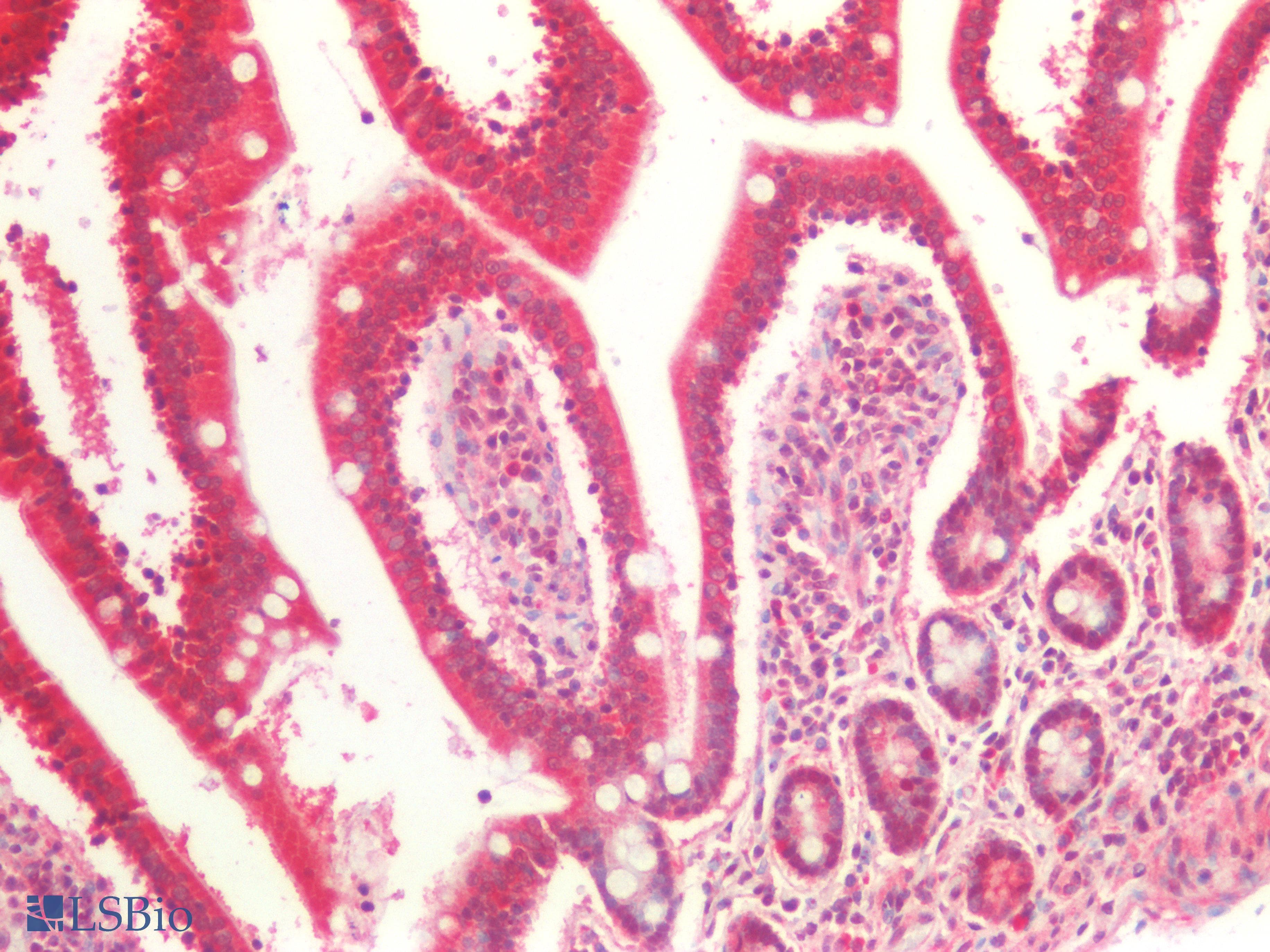 PathPlus™ Polyclonal Rabbit anti-Human Acetyl-CoA Carboxylase / ACC Antibody (N-Terminus, IHC, WB)