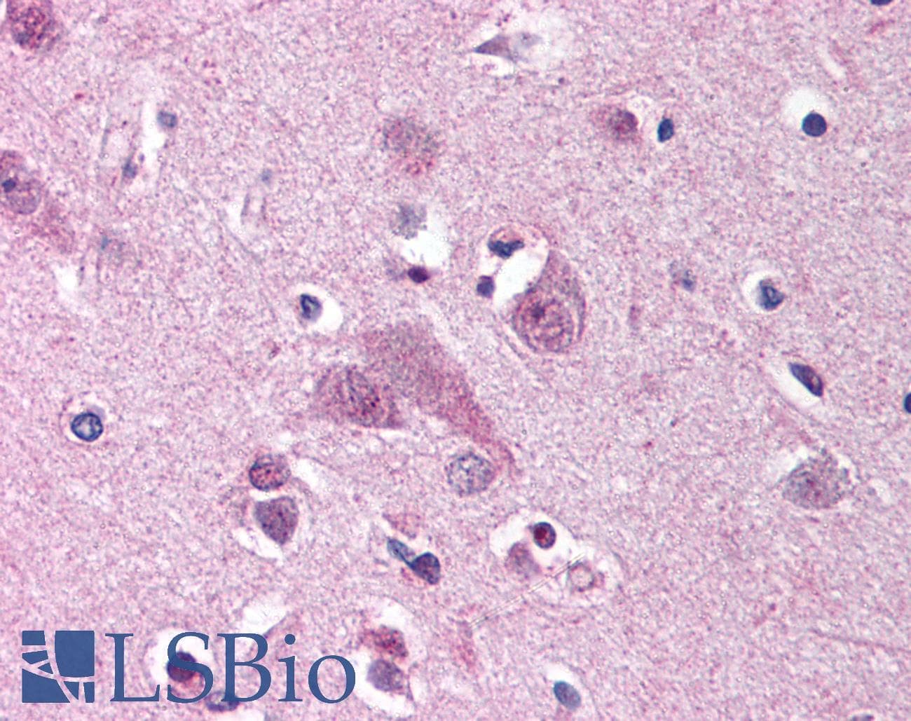 IHC-plus™ Polyclonal Rabbit anti-Human MARK1 / MARK Antibody (N-Terminus, IHC)
