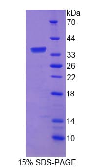 Rat APBB3 Protein (Recombinant His)