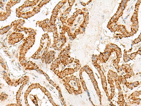 Polyclonal Rabbit anti-Human NUP210 / gp210 Antibody (IHC)