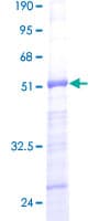 Human RPS5 / Ribosomal Protein S5 (Recombinant GST)