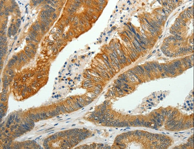 Polyclonal Rabbit anti-Human PTPN6 / SHP1 Antibody (IHC, WB)