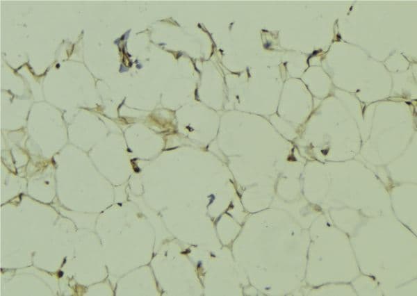 MAGEA11 Antibody