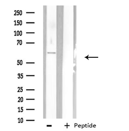 PHYKPL / AGXT2L2 Antibody