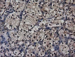 DSTN / Destrin Antibody (clone OTI1D5)