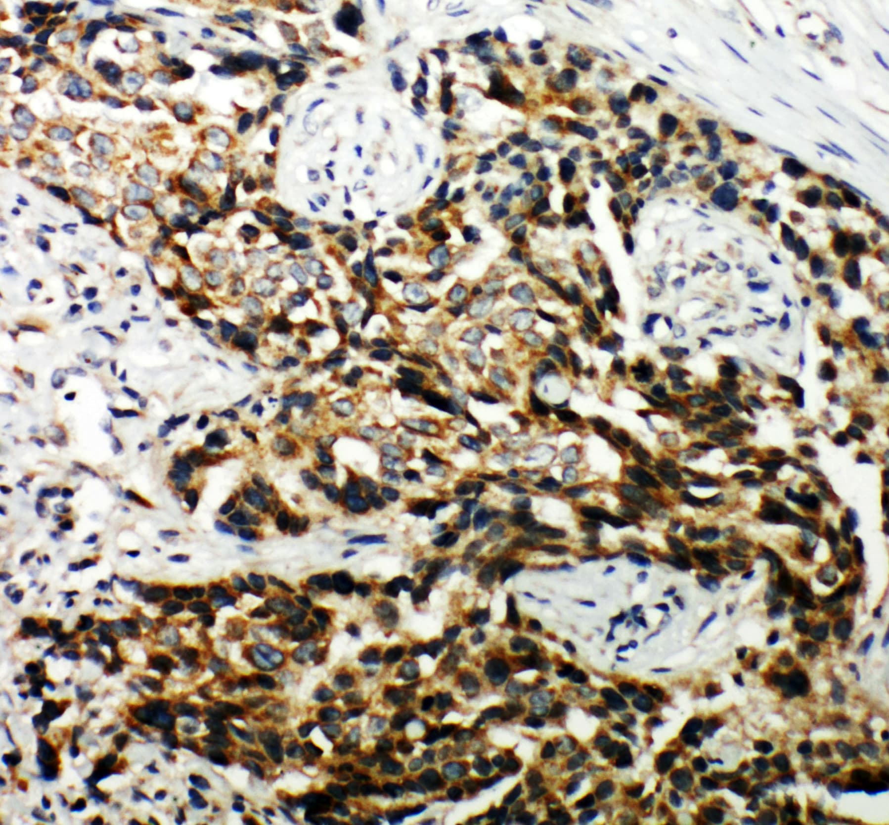 Polyclonal Rabbit anti-Human Hamartin / TSC1 Antibody (aa1150-1164, IHC, WB)