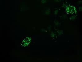 PDF / PLAB Antibody (clone OTI3F3)