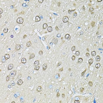PSMB1 Antibody