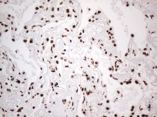 Monoclonal Mouse anti-Human HNRNPL / hnRNP L Antibody (clone OTI4E5, aa270-502, IHC)