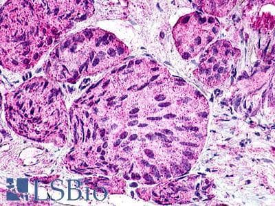 PathPlus™ Polyclonal Rabbit anti-Human GPR21 Antibody (Cytoplasmic Domain, IHC)
