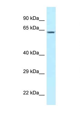 CCT3 Antibody (C-Terminus)