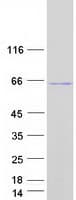 Human A1CF / ACF Protein (Recombinant Myc-DDK (Flag))