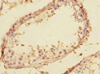 U2AF1L4 Antibody