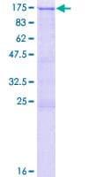 Human ADD2 Protein (Recombinant GST)