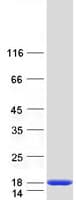 Human TIMM13 Protein (Recombinant Myc-DDK (Flag))