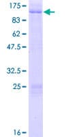 Human AKAP8 / AKAP95 Protein (Recombinant GST)