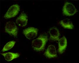PRKAB1 / AMPK Beta 1 Antibody